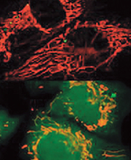 ヒト血管内皮細胞のミトコンドリア（上図赤色）と、酸化ストレス時の活性酸素（下図黄色）