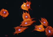 蛍光染色した骨芽細胞