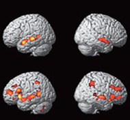 fMRIを用いた脳の活動状態