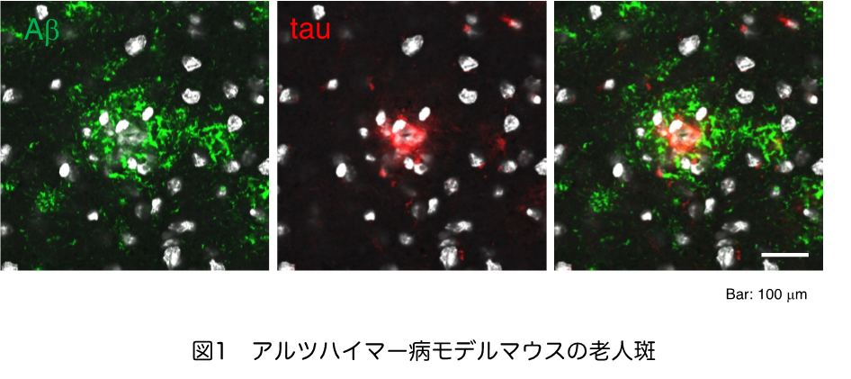 生命医科学研究科 医生命システム専攻 東優人さん、生野幹太さんらの研究成果が、「Biochemical and Biophysical Research Communications」に5月14日付で掲載されました。(1) (113287)