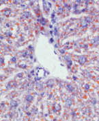 脂肪肝モデルマウスの肝臓